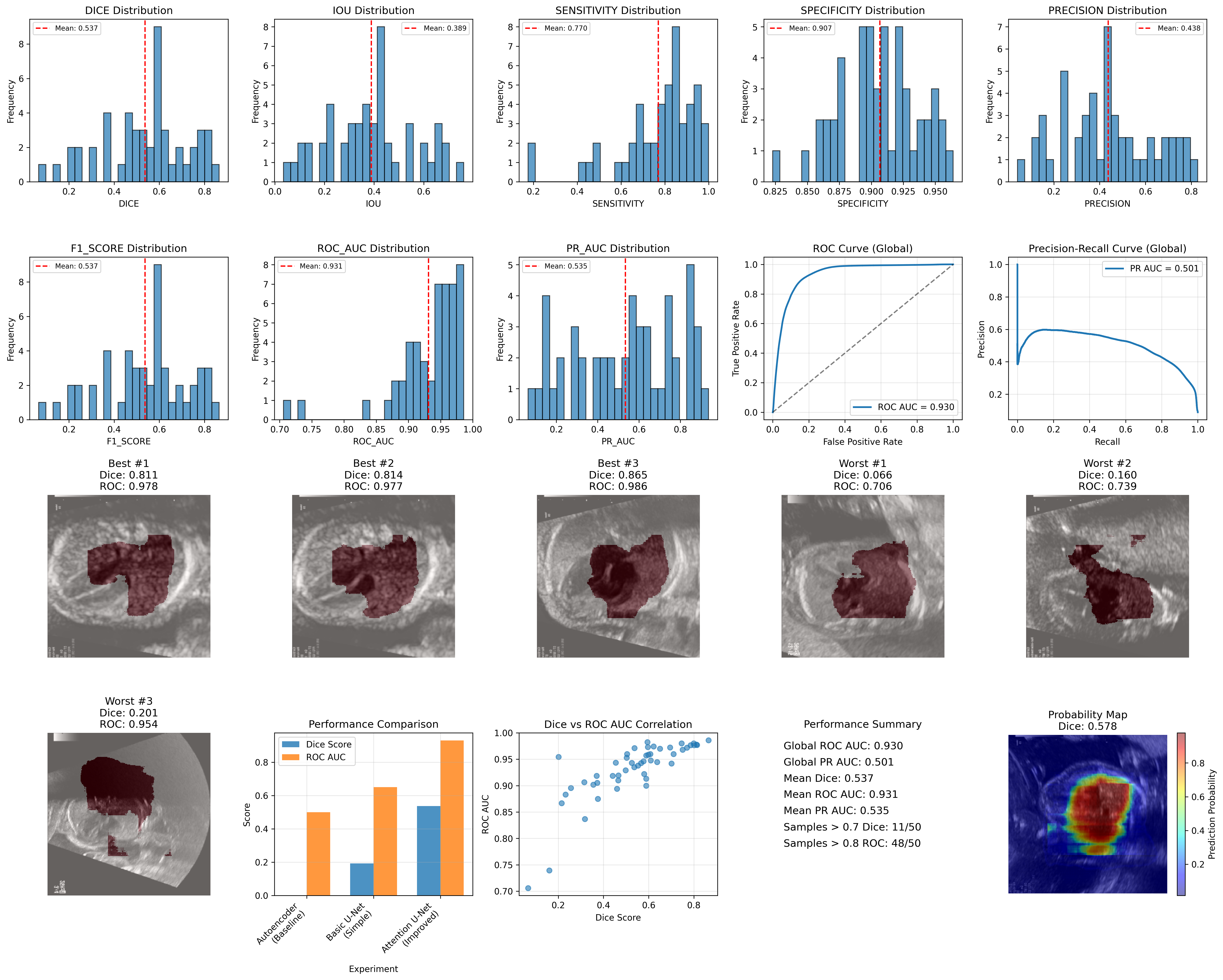 Comprehensive results from the FOCUS dataset segmentation study