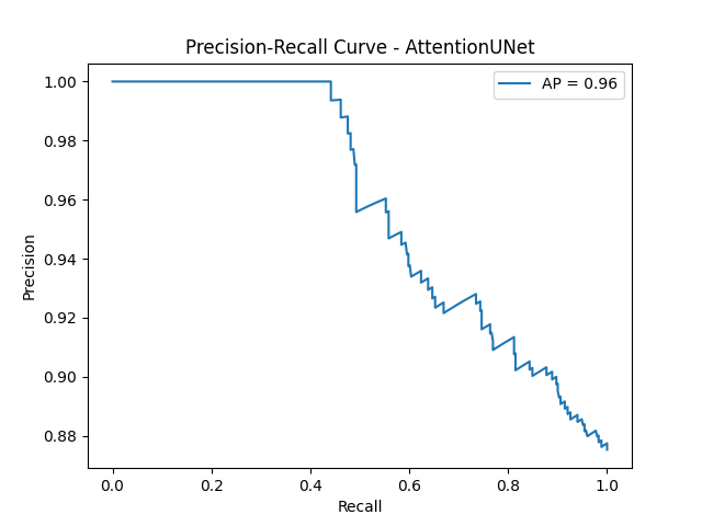 Attention UNet PR Curve