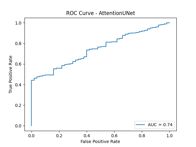 Attention UNet ROC Curve