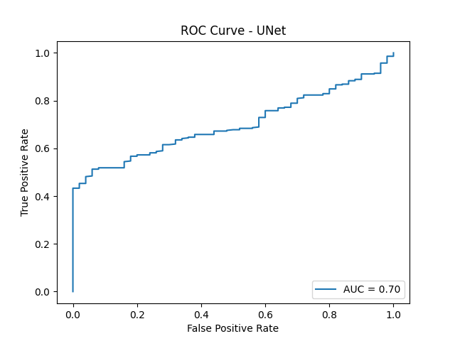 UNet ROC Curve